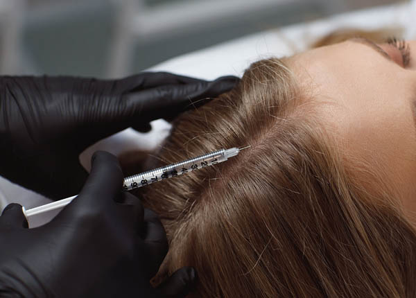 Blog trapianto capelli