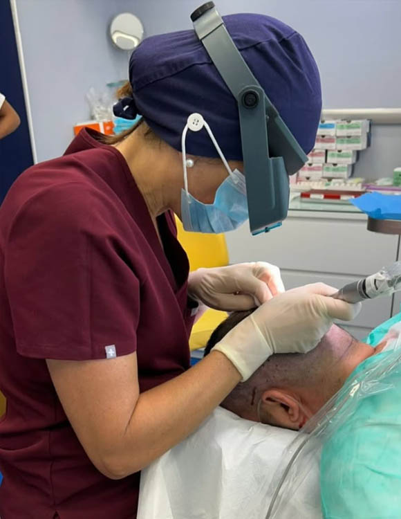 Trapianto dei capelli